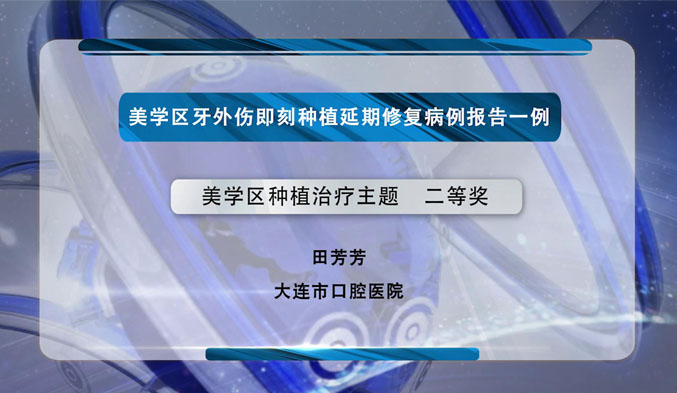 美学区牙外伤即刻种植延期修复病例报告一例