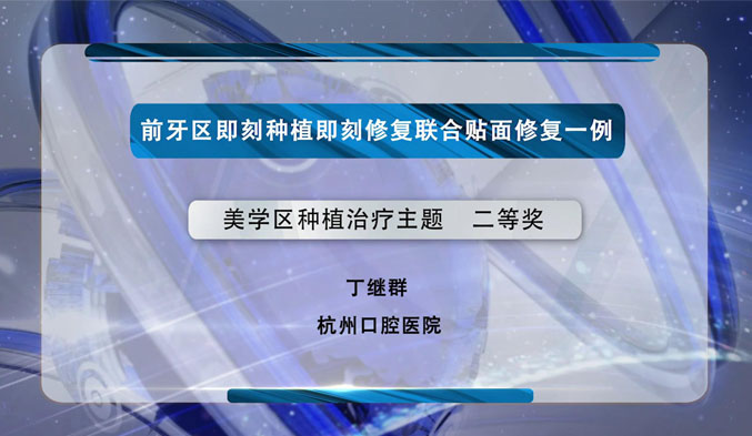 前牙区即刻种植即刻修复联合贴面修复一例