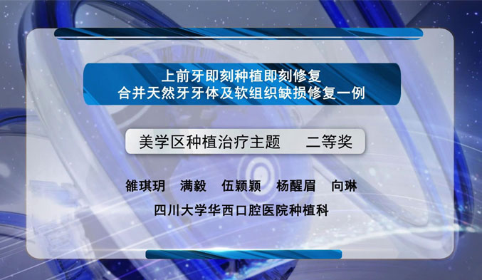 上前牙即刻种植即刻修复合并天然牙牙体及软组织缺损修复一例