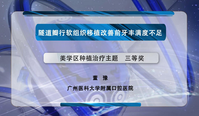 隧道瓣行软组织移植改善前牙丰满度不足