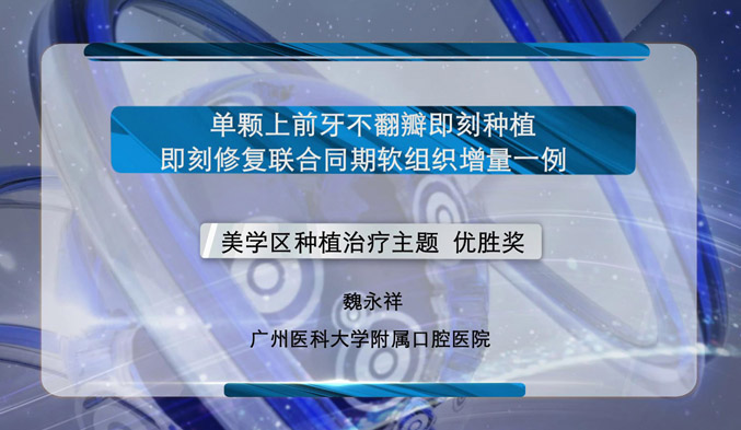 单颗上前牙不翻瓣即刻种植即刻修复联合同期软组织增量一例