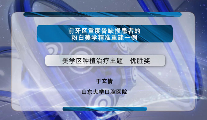 前牙区重度骨缺损患者的粉白美学精准重建一例