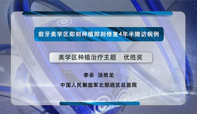 前牙美学区即刻种植即刻修复4年半随访病例