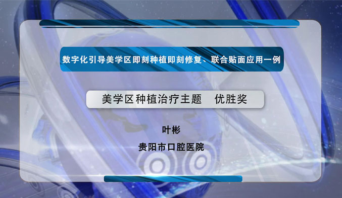 数字化引导美学区即刻种植即刻修复、联合贴面应用一例