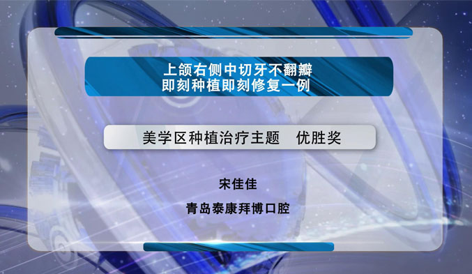 上颌右侧中切牙不翻瓣即刻种植即刻修复一例