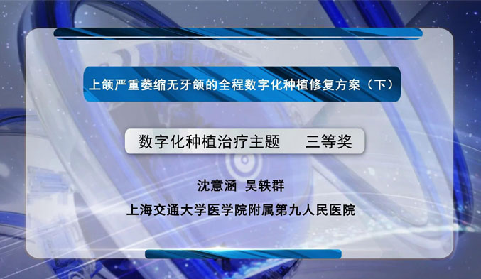 上颌严重萎缩无牙颌的全程数字化种植修复方案（下）