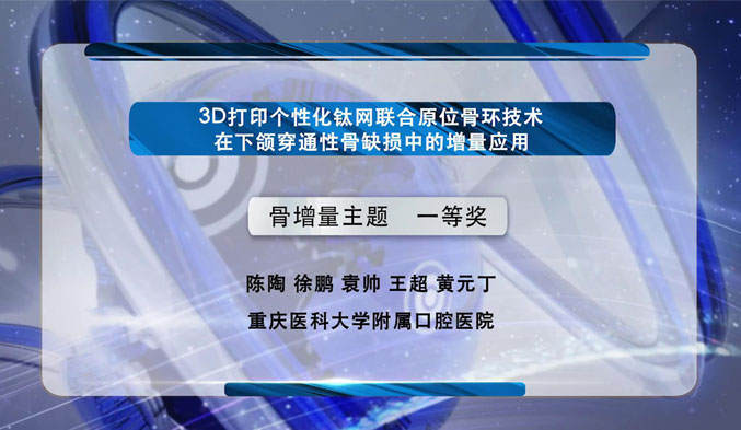 3D打印个性化钛网联合原位骨环技术在下颌穿通性骨缺损中的增量应用