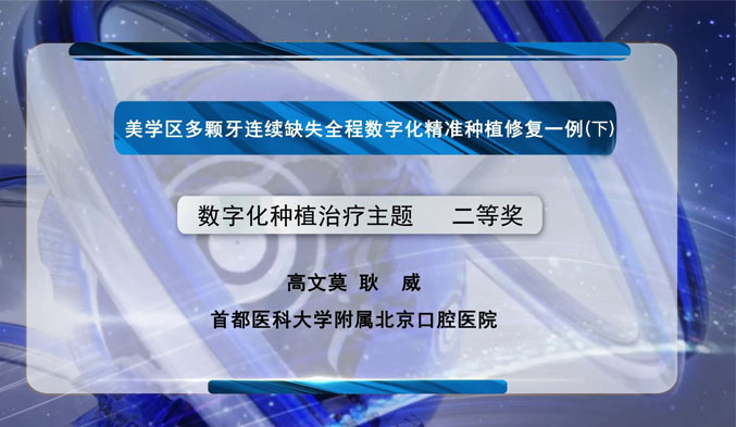 美学区多颗牙连续缺失全程数字化精准种植修复一例（上）