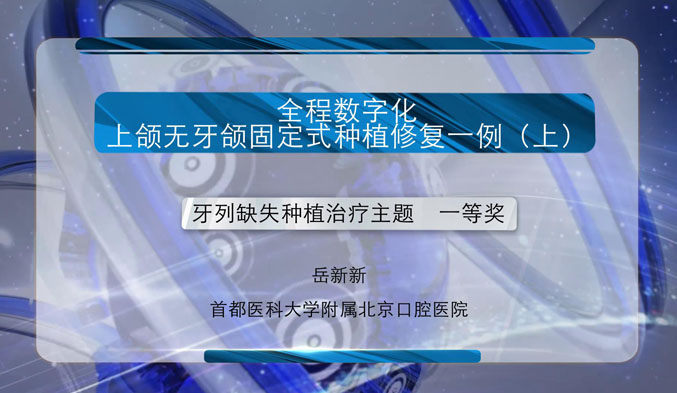 全程数字化上颌无牙颌固定式种植修复一例（上）