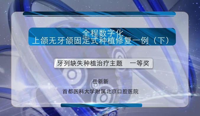 全程数字化上颌无牙颌固定式种植修复一例（下）
