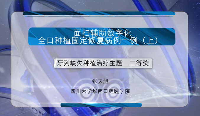 面扫辅助数字化全口种植固定修复病例一例（上）