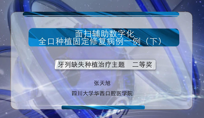 面扫辅助数字化全口种植固定修复病例一例（下）