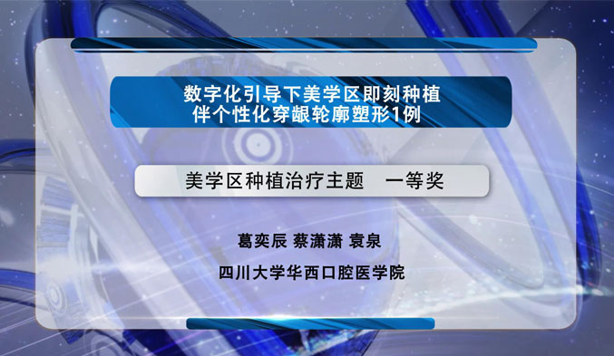 数字化引导下美学区即刻种植伴个性化穿龈轮廓塑形一例