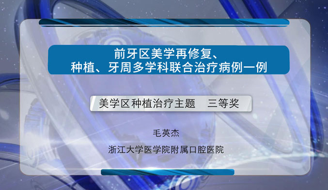 前牙区美学再修复、种植、牙周多学科联合治疗病例一例