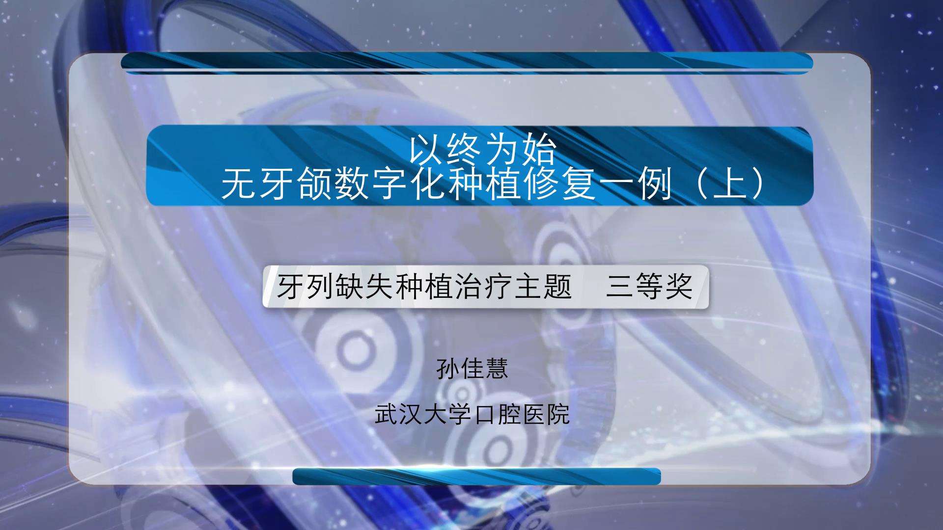 “以终为始”——无牙颌数字化种植修复一例（上）