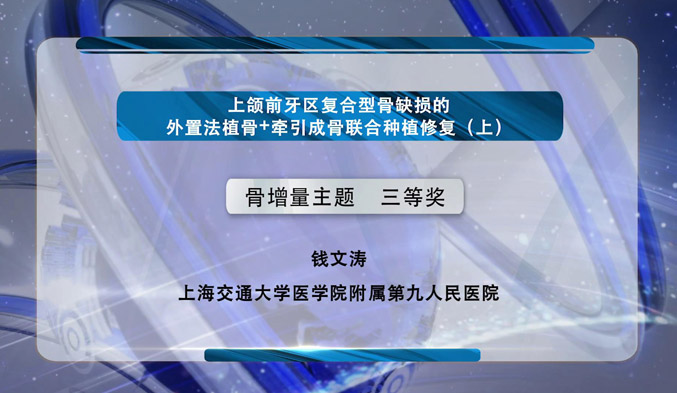 上颌前牙区复合型骨缺损的外置法植骨+牵引成骨联合种植修复（上）