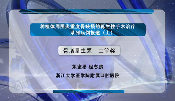 种植体周围炎重度骨缺损的再生性手术治疗——系列病例报道（上）