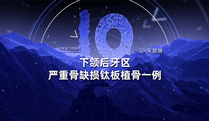 下颌后牙区严重骨缺损钛板植骨一例