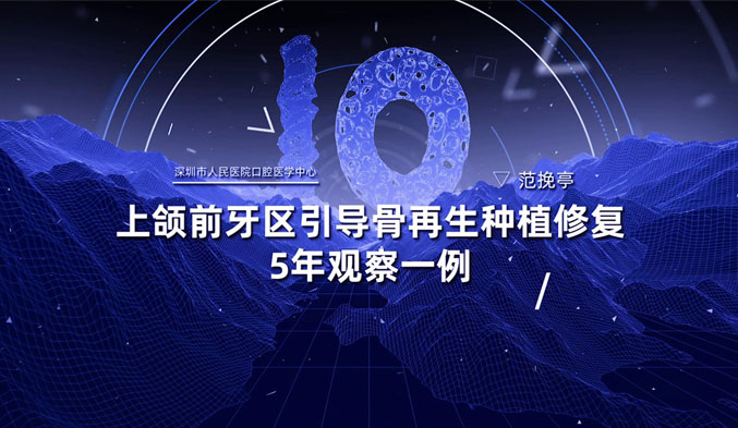 上颌前牙区引导骨再生种植修复5年观察一例