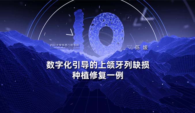 数字化引导的上颌牙列缺损种植修复⼀例