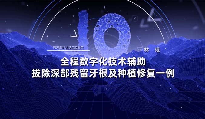 全程数字化技术辅助拔除深部残留牙根及种植修复一例