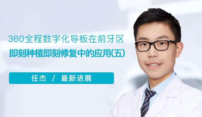 360全程数字化导板在前牙区即刻种植即刻修复中的应用（五）