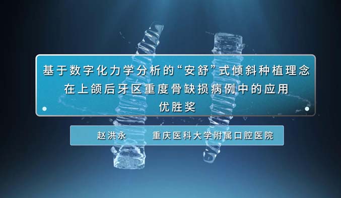 基于数字化力学分析的“安舒”式倾斜种植理念在上颌后牙区重度骨缺损病例中的应用