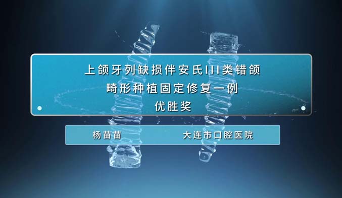 上颌牙列缺损伴安氏III类错颌畸形种植固定修复一例