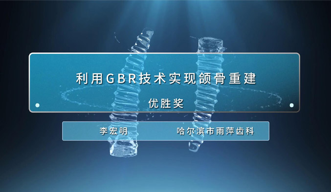 利用GBR技术实现颌骨重建