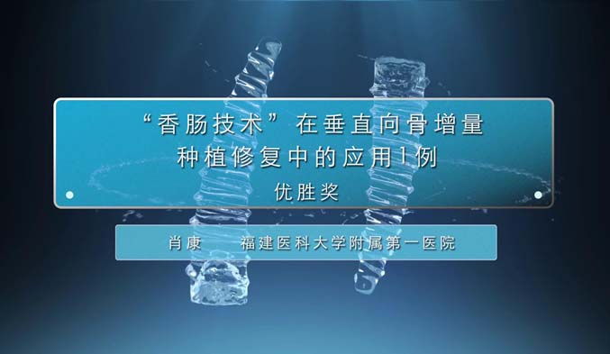 “香肠技术”在垂直向骨增量种植修复中的应用一例