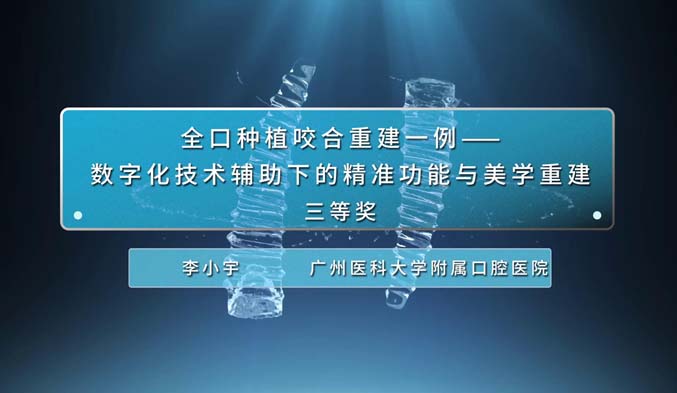 全口种植咬合重建一例--数字化技术辅助下的精准功能与美学重建