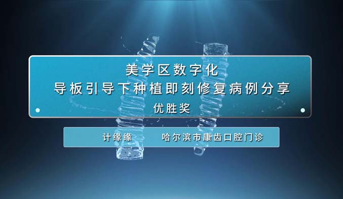 美学区数字化导板引导下种植即刻修复病例分享