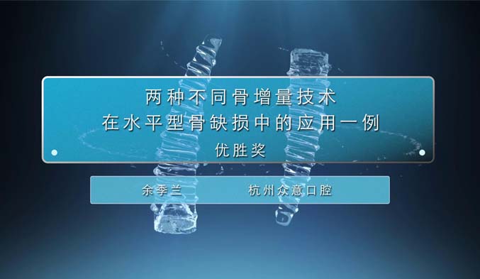 两种不同骨增量技术在水平型骨缺损中的应用一例