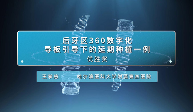 后牙区360数字化导板引导下的延期种植一例