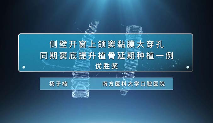 侧壁开窗上颌窦黏膜大穿孔同期窦底提升植骨延期种植一例