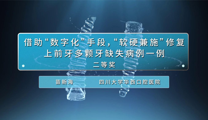 借助“数字化”手段，“软硬兼施”修复上前牙多颗牙缺失病例一例