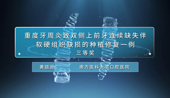 重度牙周炎致双侧上前牙连续缺失伴软硬组织缺损的种植修复一例