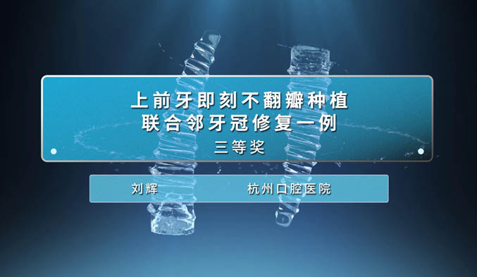 上前牙即刻不翻瓣种植联合邻牙冠修复一例