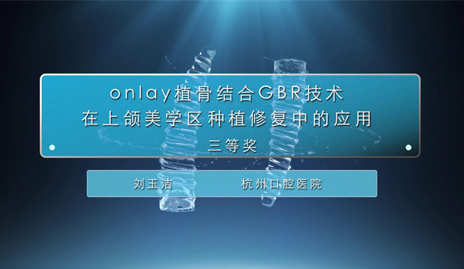 Onlay植骨结合GBR技术在上颌美学区种植修复中的应用