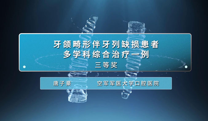 牙颌畸形伴牙列缺损患者多学科综合治疗一例