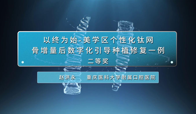 以终为始-美学区个性化钛网骨增量后数字化引导种植修复一例