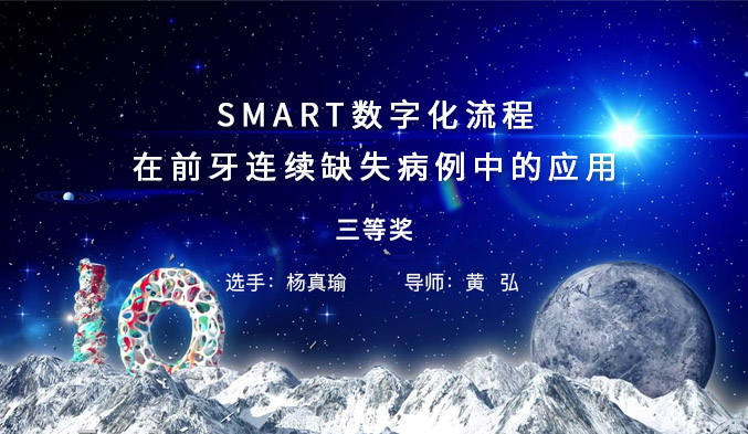 SMART数字化流程在前牙连续缺失病例中的应用