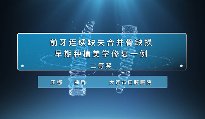 前牙连续缺失合并骨缺损早期种植美学修复一例