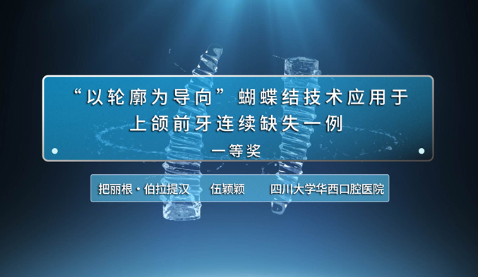 “以轮廓为导向”蝴蝶结技术应用于上颌前牙连续缺失一例