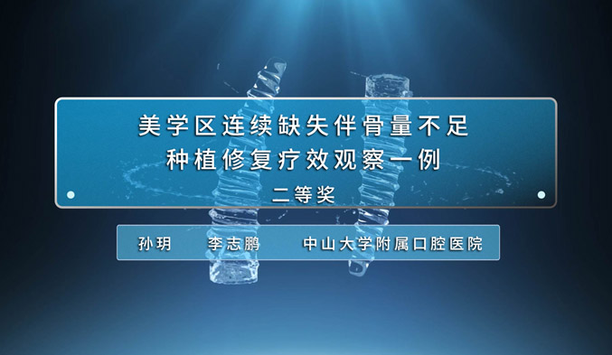 美学区连续缺失伴骨量不足种植修复疗效观察一例