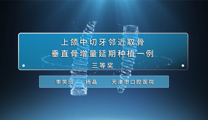 上颌中切牙邻近取骨垂直骨增量延期种植一例