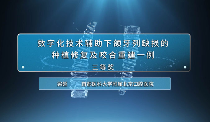 数字化技术辅助下颌牙列缺损的种植修复及咬合重建一例