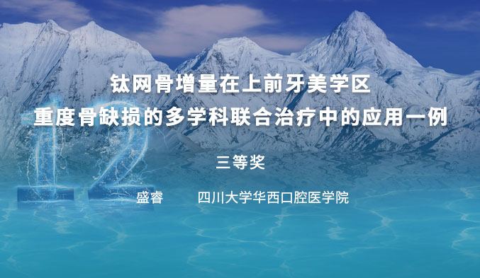 钛网骨增量在上前牙美学区重度骨缺损的多学科联合治疗中的应用一例