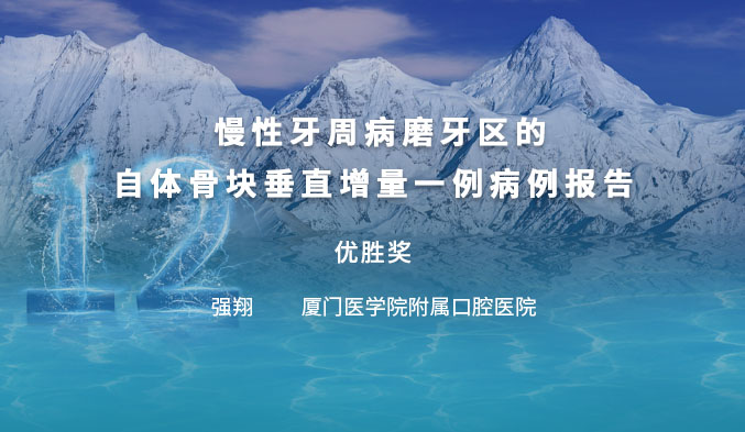 慢性牙周病磨牙区的自体骨块垂直增量一例病例报告