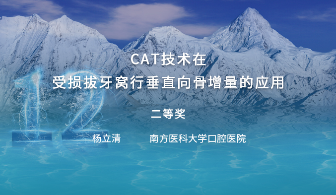 皮质骨片锚定技术（CAT）在垂直向骨增量中的应用